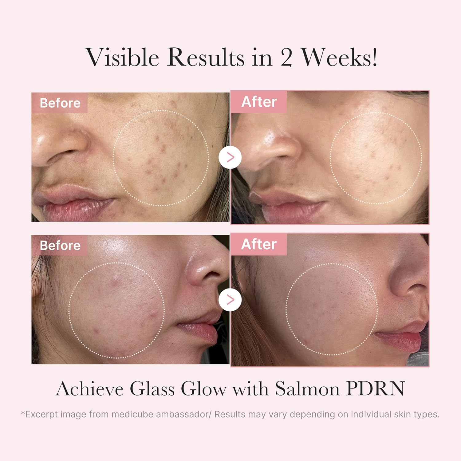 medicube Pink PDRN Trio Gift Set for Glass Glow Skin -Hydrating, Firming, and Radiance-Boosting Skincare Set for Women & Girls | With Salmon DNA PDRN, Peptides and Pink Vitamin | Korean Skincare